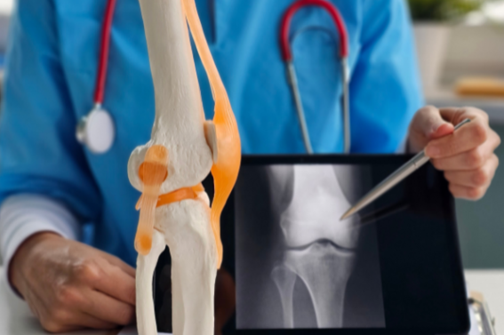 5 Best Physical Therapy Exercises for Patellofemoral Knee Pain (Runner's Knee)